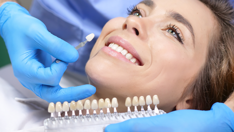 Detailed Analysis On Professional Teeth Whitening